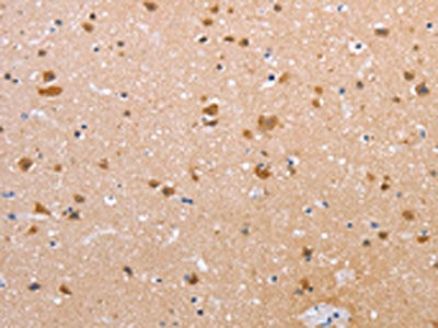 The image on the left is immunohistochemistry of paraffin-embedded Human brain tissue using CSB-PA358271(CLDN10 Antibody) at dilution 1/50, on the right is treated with synthetic peptide. (Original magnification: ×200)