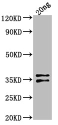 Western Blot Positive WB detected in Recombinant protein All lanes: ARCA antibody at 1:2000 Secondary Goat polyclonal to rabbit IgG at 1/50000 dilution Predicted band size: 31.4 kDa Observed band size: 33 kDa