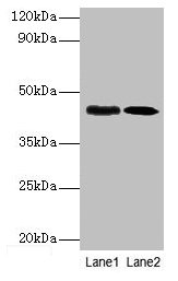 Western blot All lanes: lapB antibody at 1: 1000 Lane1: DH5α whole cell lysate at 10µg Lane2: DH5α whole cell lysate at 1µg Secondary Goat polyclonal to rabbit IgG at 1/10000 dilution Predicted band size: 45 kDa Observed band size: 45 kDa