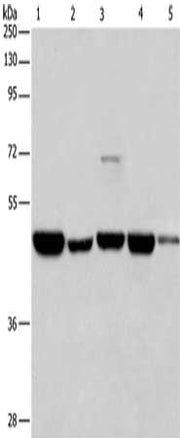 Gel: 8%SDS-PAGE, Lysate: 40 ug, Lane 1-5: 231 cells, A375 cells, K562 cells, Hela cells, HepG2 cells, Primary antibody: CSB-PA359877(HNRNPF Antibody) at dilution 1/350, Secondary antibody: Goat anti rabbit IgG at 1/8000 dilution, Exposure time: 1...