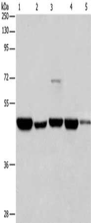 Gel: 8%SDS-PAGE, Lysate: 40 ug, Lane 1-5: 231 cells, A375 cells, K562 cells, Hela cells, HepG2 cells, Primary antibody: CSB-PA359877(HNRNPF Antibody) at dilution 1/350, Secondary antibody: Goat anti rabbit IgG at 1/8000 dilution, Exposure time: 1...