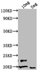 Western Blot Positive WB detected in Recombinant protein All lanes: nlpD antibody at 1:2000 Secondary Goat polyclonal to rabbit IgG at 1/50000 dilution Predicted band size: 55.29 kDa Observed band size: 21 kDa