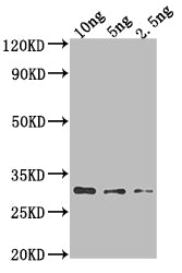 Western Blot Positive WB detected in Recombinant protein All lanes: AADB antibody at 1:2000 Secondary Goat polyclonal to rabbit IgG at 1/50000 dilution Predicted band size: 24.9 kDa Observed band size: 28 kDa