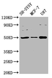 Western Blot Positive WB detected in: SH-SY5Y whole cell lysate, MCF-7 whole cell lysate, U87 whole cell lysate All lanes: IGHM antibody at 3.4µg/ml Secondary Goat polyclonal to rabbit IgG at 1/50000 dilution Predicted band size: 50, 52 kDa Observ...