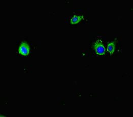 Immunofluorescent analysis of Hela cells using CSB-PA360881HA01MO at dilution of 1:100 and Alexa Fluor 488-congugated AffiniPure Goat Anti-Rabbit IgG(H+L)