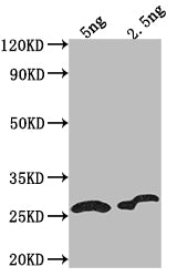 Western Blot Positive WB detected in Recombinant protein All lanes: D antibody at 1:2000 Secondary Goat polyclonal to rabbit IgG at 1/50000 dilution Predicted band size: 16.21 kDa Observed band size: 17 kDa