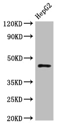 Western Blot Positive WB detected in: HepG2 whole cell lysate All lanes: HLA-B antibody at 1:1000 Secondary Goat polyclonal to rabbit IgG at 1/50000 dilution Predicted band size: 41 kDa Observed band size: 45 kDa