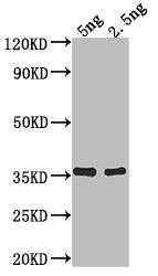 Western Blot Positive WB detected in Recombinant protein All lanes: fimA antibody at 1:2000 Secondary Goat polyclonal to rabbit IgG at 1/50000 dilution Predicted band size: 31.8 kDa Observed band size: 36 kDa