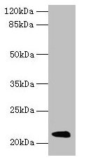 Western blot All lanes: Mup11 antibody at 2µg/ml + Mouse liver tissue Secondary Goat polyclonal to rabbit IgG at 1/10000 dilution Predicted band size: 21 kDa Observed band size: 21 kDa