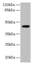 Western blot All lanes: cpg2 antibody at 2µg/ml + Recombinant Carboxypeptidase G2 protein at 0.5µg Secondary Goat polyclonal to rabbit IgG at 1/10000 dilution Predicted band size: 44 kDa Observed band size: 44 kDa