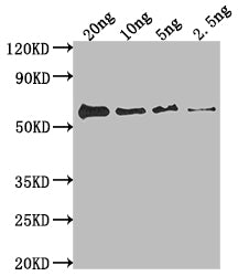 Western Blot Positive WB detected in Recombinant protein All lanes: fimH antibody at 1:2000 Secondary Goat polyclonal to rabbit IgG at 1/50000 dilution Predicted band size: 59.1 kDa Observed band size: 59 kDa