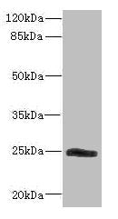 Western blot All lanes: SNRPB2 antibody IgG at 2.26ug/ml + Mouse kidney tissue Secondary Goat polyclonal to rabbit IgG at 1/10000 dilution Predicted band size: 25 kDa Observed band size: 25 kDa