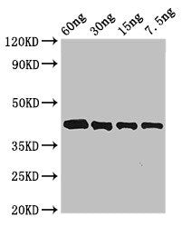 Western Blot Positive WB detected in Recombinant protein All lanes: Arginine esterase antibody at 3µg/ml Secondary Goat polyclonal to rabbit IgG at 1/50000 dilution predicted band size: 42 kDa observed band size: 42 kDa