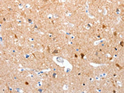 The image on the left is immunohistochemistry of paraffin-embedded Human brain tissue using CSB-PA363377(GPR6 Antibody) at dilution 1/10, on the right is treated with synthetic peptide. (Original magnification: ×200)