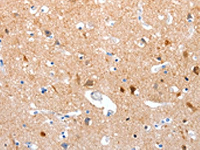 The image on the left is immunohistochemistry of paraffin-embedded Human brain tissue using CSB-PA363377(GPR6 Antibody) at dilution 1/10, on the right is treated with synthetic peptide. (Original magnification: ×200)