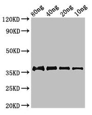 Western Blot Positive WB detected in Recombinant protein All lanes: fbpC antibody at 2.8µg/ml Secondary Goat polyclonal to rabbit IgG at 1/50000 dilution Predicted band size: 37 kDa Observed band size: 37 kDa