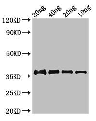 Western Blot Positive WB detected in Recombinant protein All lanes: fbpC antibody at 2.8µg/ml Secondary Goat polyclonal to rabbit IgG at 1/50000 dilution Predicted band size: 37 kDa Observed band size: 37 kDa