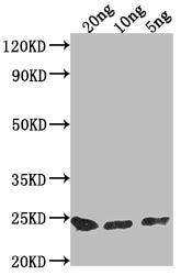 Western Blot Positive WB detected in Recombinant protein All lanes: PNCC antibody at 1:2000 Secondary Goat polyclonal to rabbit IgG at 1/50000 dilution Predicted band size: 21.7 kDa Observed band size: 23 kDa