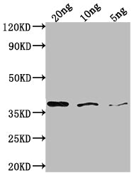 Western Blot Positive WB detected in Recombinant protein All lanes: bamA antibody at 1:2000 Secondary Goat polyclonal to rabbit IgG at 1/50000 dilution Predicted band size: 36 kDa Observed band size: 38 kDa