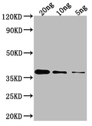 Western Blot Positive WB detected in Recombinant protein All lanes: GLMU antibody at 1:2000 Secondary Goat polyclonal to rabbit IgG at 1/50000 dilution Predicted band size: 37.7 kDa Observed band size: 35 kDa