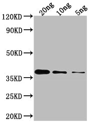 Western Blot Positive WB detected in Recombinant protein All lanes: GLMU antibody at 1:2000 Secondary Goat polyclonal to rabbit IgG at 1/50000 dilution Predicted band size: 37.7 kDa Observed band size: 35 kDa