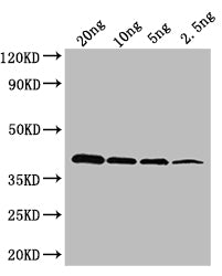Western Blot Positive WB detected in: recombinant protein All lanes: oxyR Antibody at 1:1000 Secondary Goat polyclonal to rabbit IgG at 1/50000 dilution Predicted band size: 36 kDa Observed band size: 36 kDa