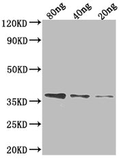 Western Blot Positive WB detected in Recombinant protein All lanes: FTSI antibody at 1:2000 Secondary Goat polyclonal to rabbit IgG at 1/50000 dilution Predicted band size: 32.4 kDa Observed band size: 38 kDa