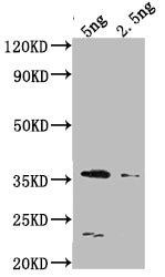 Western Blot Positive WB detected in Recombinant protein All lanes: DCM antibody at 1:2000 Secondary Goat polyclonal to rabbit IgG at 1/50000 dilution Predicted band size: 36.5 kDa Observed band size: 34 kDa