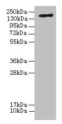 Western blot All lanes: C3 antibody at 20µg/ml + Human high value serum Secondary Goat polyclonal to rabbit IgG at 1/10000 dilution Predicted band size: 187, 61 kDa Observed band size: 187 kDa