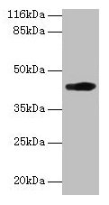 Western blot All lanes: H2-D1 antibody at 2µg/ml + A549 whole cell lysate Secondary Goat polyclonal to rabbit IgG at 1/10000 dilution Predicted band size: 42 kDa Observed band size: 42 kDa