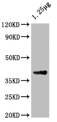 Western Blot Positive WB detected in: Escherichia coli lysate All lanes: ompF antibody at 1:2000 Secondary Goat polyclonal to rabbit IgG at 1/50000 dilution Predicted band size: 40 kDa Observed band size: 40 kDa