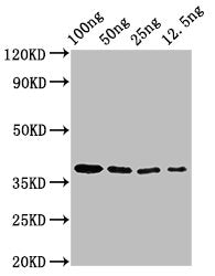 Western Blot Positive WB detected in Recombinant protein All lanes: BZLF2 antibody at 3µg/ml Secondary Goat polyclonal to rabbit IgG at 1/50000 dilution Predicted band size: 38 kDa Observed band size: 38 kDa