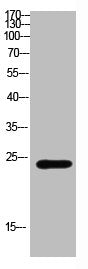 Western Blot analysis of mouse-brain cells using Antibody diluted at 800. Secondary antibody was diluted at 1:20000