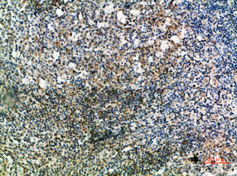 Immunohistochemical analysis of paraffin-embedded human-tonsil, antibody was diluted at 1:200