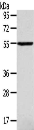 Gel: 6%SDS-PAGE,Lysate: 40 ug,,Primary antibody: CSB-PA371613(SLC16A11 Antibody) at dilution 1/320 dilution,Secondary antibody: Goat anti rabbit IgG at 1/8000 dilution,Exposure time: 10 minutes