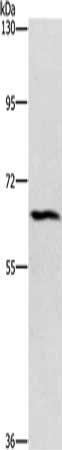 Gel: 6%SDS-PAGE, Lysate: 40 ug, Lane: Hela cells, Primary antibody: CSB-PA378558(CERKL Antibody) at dilution 1/1100, Secondary antibody: Goat anti rabbit IgG at 1/8000 dilution, Exposure time: 1 minute