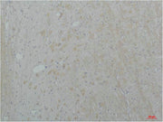 Immunohistochemical analysis of paraffin-embedded Rat Brain Tissue using Cav2.2Rabbit pAb diluted at 1:200.