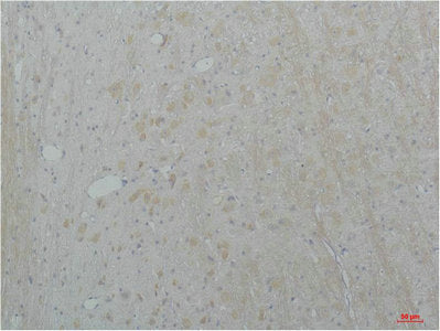 Immunohistochemical analysis of paraffin-embedded Rat Brain Tissue using Cav2.2Rabbit pAb diluted at 1:200.