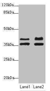 Western blot All lanes: IKBIPantibody at 2.23ug/ml Lane 1: Mouse kidney tissue Lane 2: HL60 whole cell lysate Secondary Goat polyclonal to rabbit IgG at 1/10000 dilution Predicted band size: 40, 28, 8, 44 kDa Observed band size: 40, 36 kDa