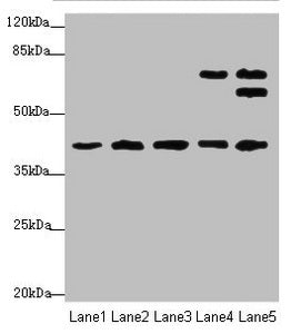 Western blot All lanes: IKBIPantibody at 4.49ug/ml Lane 1: Mouse kidney tissue Lane 2: Mouse lung tissue Lane 3: Mouse spleen tissue Lane 4: HL60 whole cell lysate Lane 5: HepG2 whole cell lysate Secondary Goat polyclonal to rabbit IgG at 1/10000...