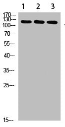 Western Blot analysis of 1,mouse-liver 2,hela 3,mouse-brain cells using primary antibody diluted at 1:1000(4°C overnight). Secondary antibody:Goat Anti-rabbit IgG IRDye 800( diluted at 1:5000, 25°C, 1 hour)