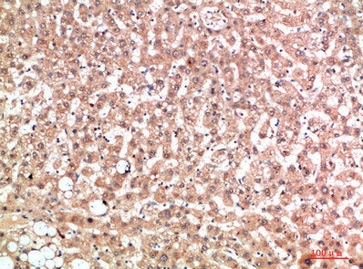 Immunohistochemical analysis of paraffin-embedded human-liver, antibody was diluted at 1:200