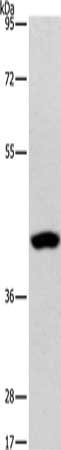 Gel: 8%SDS-PAGE, Lysate: 40 ug, Lane: Human lymphoma tissue, Primary antibody: CSB-PA387448(AGXT2L2 Antibody) at dilution 1/550, Secondary antibody: Goat anti rabbit IgG at 1/8000 dilution, Exposure time: 30 seconds