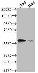 Western Blot Positive WB detected in Recombinant protein All lanes: omp38 antibody at 1:2000 Secondary Goat polyclonal to rabbit IgG at 1/50000 dilution Predicted band size: 52.5 kDa Observed band size: 66 kDa