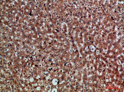 Immunohistochemical analysis of paraffin-embedded human-liver, antibody was diluted at 1:200