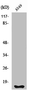Western Blot analysis of A549 cells using Fhit Polyclonal Antibody