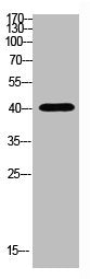 Western Blot analysis of HELA cells using Antibody diluted at 500. Secondary antibody was diluted at 1:20000