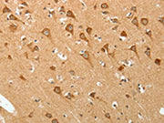 The image on the left is immunohistochemistry of paraffin-embedded Human brain tissue using CSB-PA404735(PGBD5 Antibody) at dilution 1/20, on the right is treated with synthetic peptide. (Original magnification: ×200)
