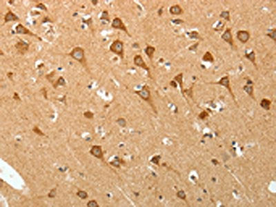 The image on the left is immunohistochemistry of paraffin-embedded Human brain tissue using CSB-PA404735(PGBD5 Antibody) at dilution 1/20, on the right is treated with synthetic peptide. (Original magnification: ×200)