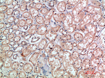 Immunohistochemical analysis of paraffin-embedded human-kidney, antibody was diluted at 1:200
